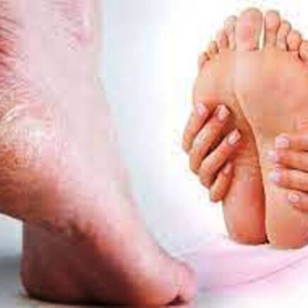 जानियें कैसे फटी हुई ऐड़ियों को घरेलू नुख्सो के जरिए कर सकती है ठीक, पढ़िये