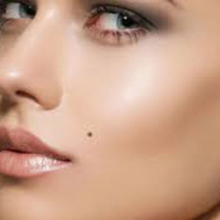 आप भी अनचाहे तिल से है परेशान, तो ऐेसे करें दूर, पढ़िये