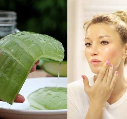 एलोवेरा का इस्तेमाल कर चेहरे से ऐसे हटाएं पिंपल्स, सुंदर आएंगी नजर