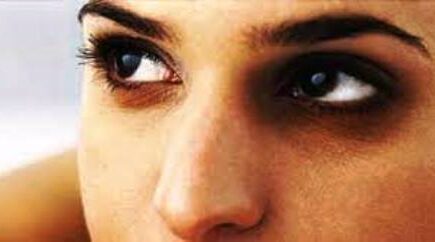 डार्क सर्कल जैसी समस्या कर रही परेशान, तो ले इन चीज की मदद, मिलेगा फायदा