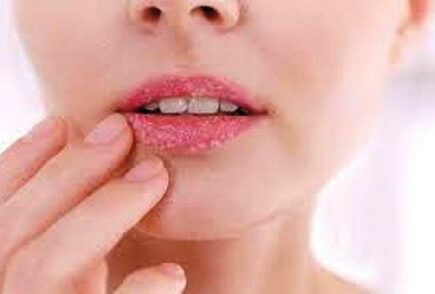 गर्मी में होंठ फटने की समस्या से है परेशान, तो इस तरह बनाएं मुलायम और खूबसूरत