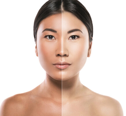 शरीर का रंग साफ तो चेहरा क्यों काला आता है नजर, क्या हो सकती है वजह, पढ़िये