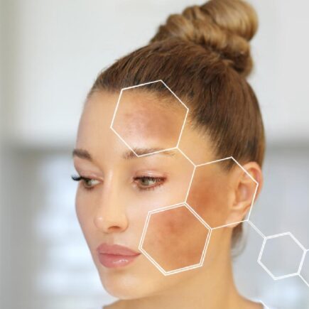 ठंड में प्रदूषण से ऐसे करे त्वचा का ख्याल, जानिये इसके बारे में