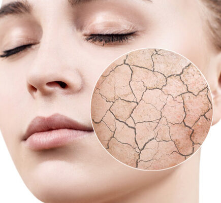 ड्राई स्किन पर चेहरे पर उपयोग करें ये चीज